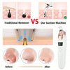 Blackhead Remover Pore Vacuum Cleaner