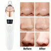 Blackhead Remover Pore Vacuum Cleaner