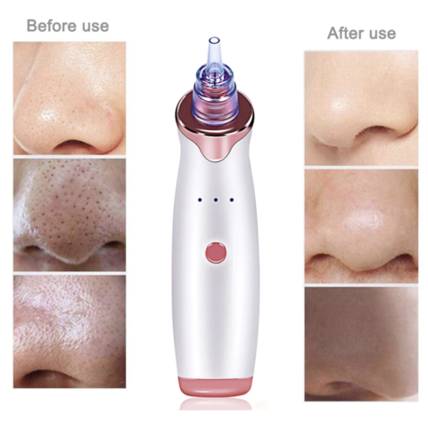 Blackhead Remover Pore Vacuum Cleaner